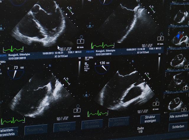 ultrazvuk a výpočet porodu 